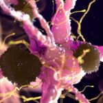 fda-approved-cancer-drug-offers-new-hope-for-parkinson-s-treatment