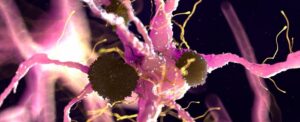 fda-approved-cancer-drug-offers-new-hope-for-parkinson-s-treatment