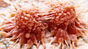 innovative-light-therapy-offers-hope-in-cancer-treatment-breakthrough