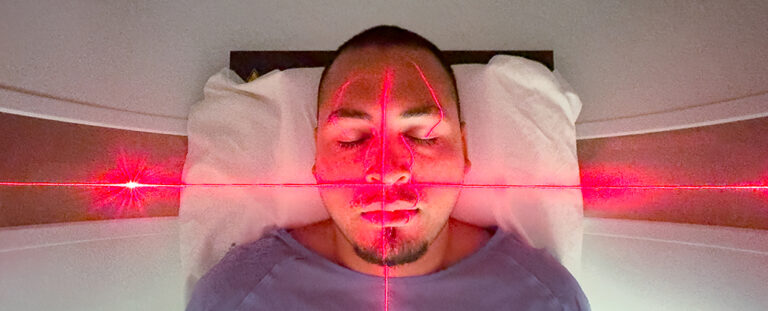 low-dose-radiation-therapy-shows-promise-for-osteoarthritis-pain-relief