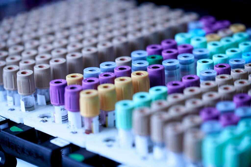 new-blood-test-revolutionizes-alzheimer-s-diagnosis-and-access