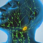 new-research-questions-lymph-node-removal-in-cancer-surgery
