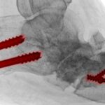 podiatric-surgeons-to-rebrand-as-surgical-podiatrists-by-2026