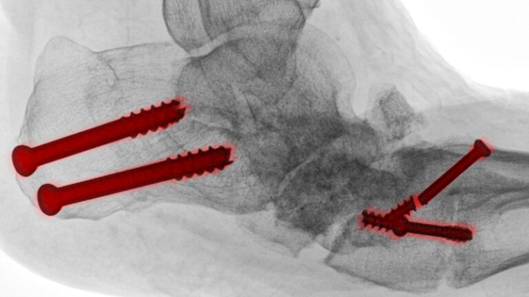 podiatric-surgeons-to-rebrand-as-surgical-podiatrists-by-2026