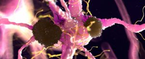 researchers-uncover-early-alzheimer-s-signal-in-brain-protein
