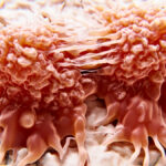 researchers-unveil-light-based-treatment-that-targets-cancer-cells
