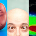 scientists-unveil-universal-kidney-breakthrough-alzheimer-s-treatment