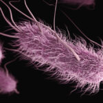 study-links-poor-kitchen-hygiene-to-1-in-5-urinary-tract-infections
