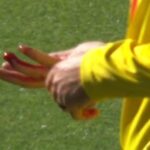 urgent-update-matt-short-injured-after-catch-attempt-bleeds