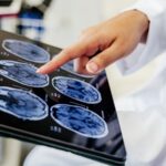 14-strategies-to-reduce-dementia-risk-and-enhance-brain-health