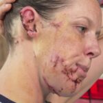 arizona-mother-hospitalized-after-violent-dog-attack-at-home