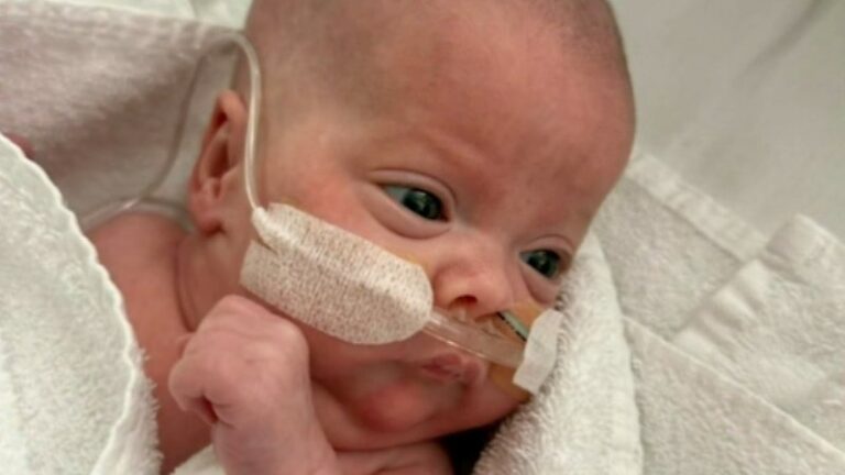 australia-celebrates-birth-of-youngest-premature-baby-at-23-weeks