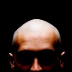 finasteride-linked-to-mental-health-risks-amid-hair-loss-treatment-