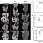 magnetoelectric-nanotherapy-shrinks-pancreatic-tumors-boosts-survival