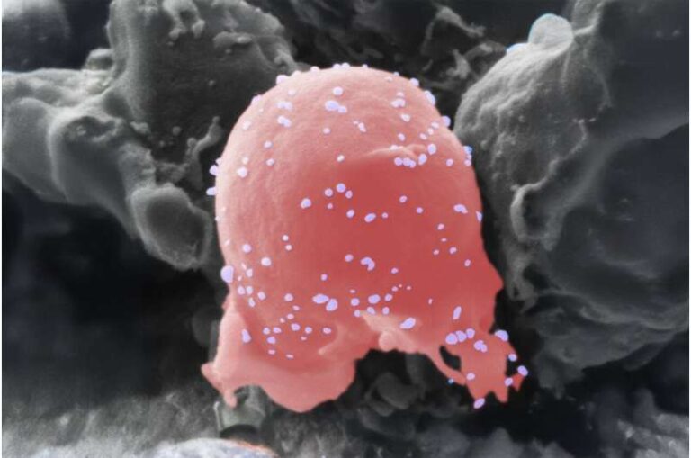 researchers-develop-innovative-cell-therapy-for-multiple-sclerosis