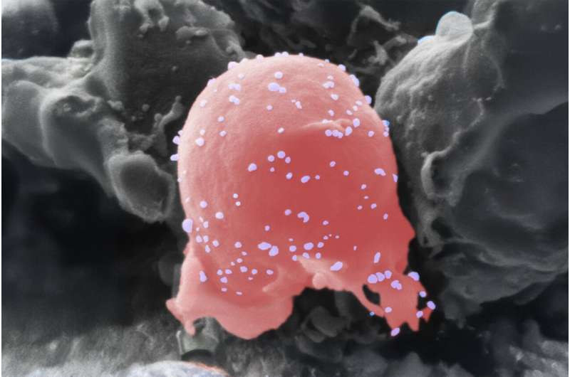 researchers-develop-innovative-cell-therapy-for-multiple-sclerosis