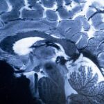 urgent-study-links-poor-heart-health-to-higher-dementia-risk