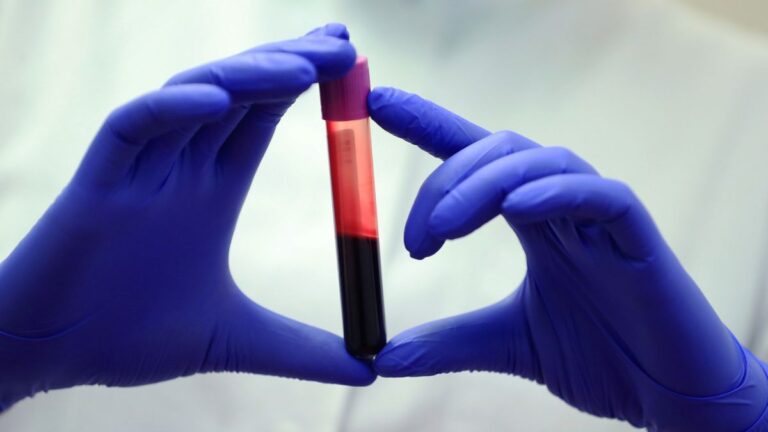 blood-analysis-of-centenarians-reveals-secrets-to-longevity