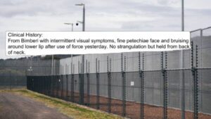 child-hospitalized-after-force-incident-at-act-youth-prison