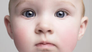 experts-link-childhood-factors-to-increased-dementia-risk