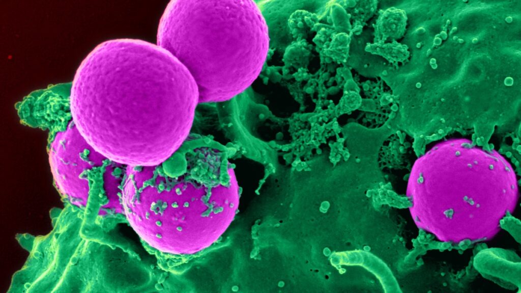 new-study-uncovers-hidden-antimicrobial-resistance-in-sewage