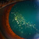 rare-condition-gives-eyes-a-sparkling-christmas-tree-effect