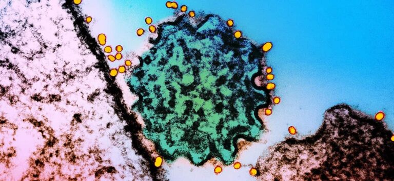 airports-on-high-alert-as-nipah-virus-raises-global-concerns