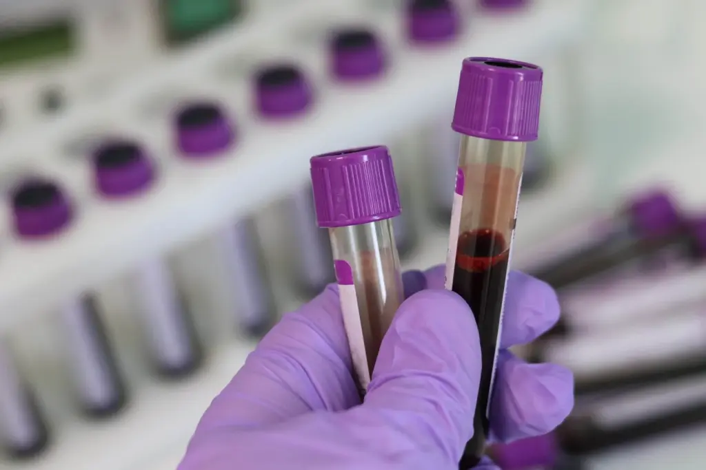 blood-test-shows-promise-in-detecting-cancer-early
