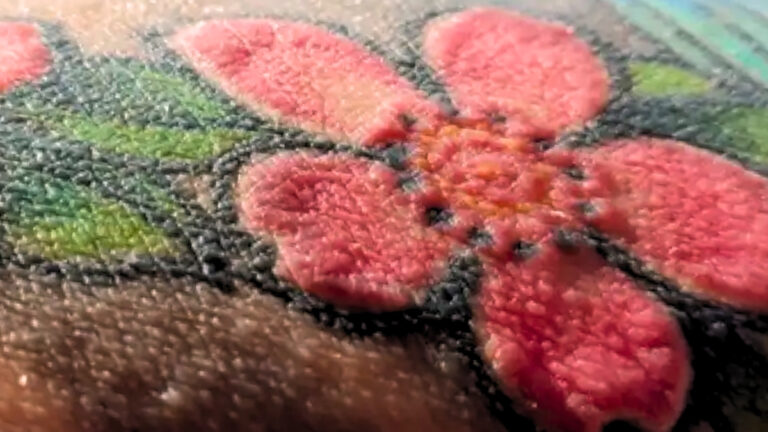 polish-man-s-tattoo-sparks-severe-health-crisis-and-surgery